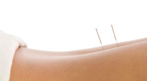 Cold Laser Therapy & Trigger Point Dry Needling